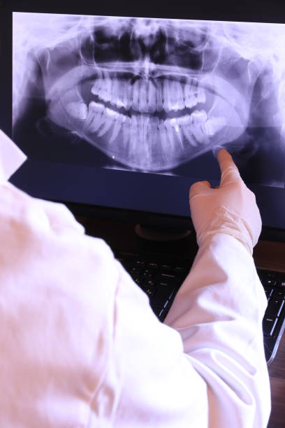 Best Emergency Tooth Extraction in Baldwin, MI