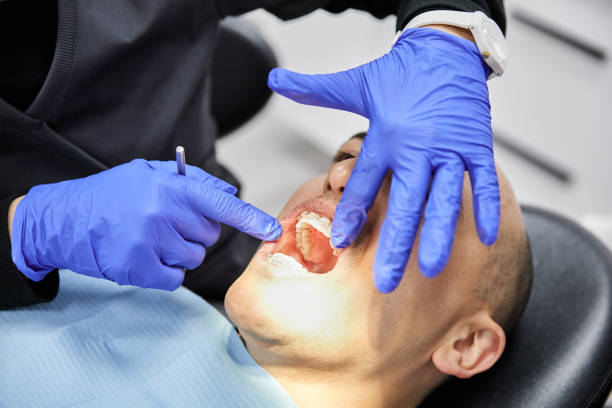 Best Emergency Tooth Extraction in Baldwin, MI